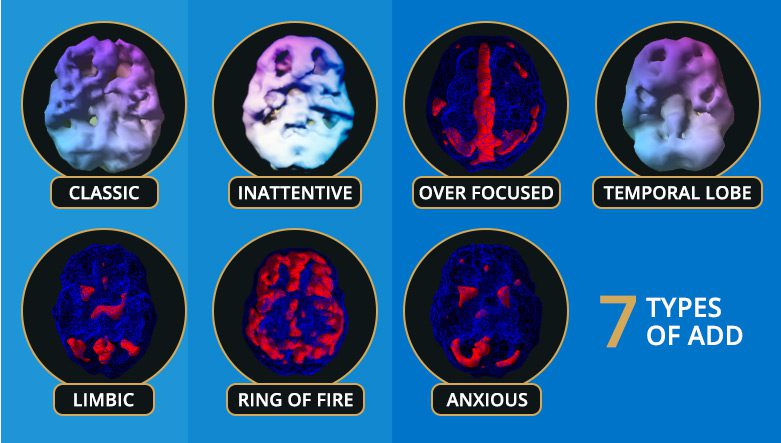 Types of ADHD